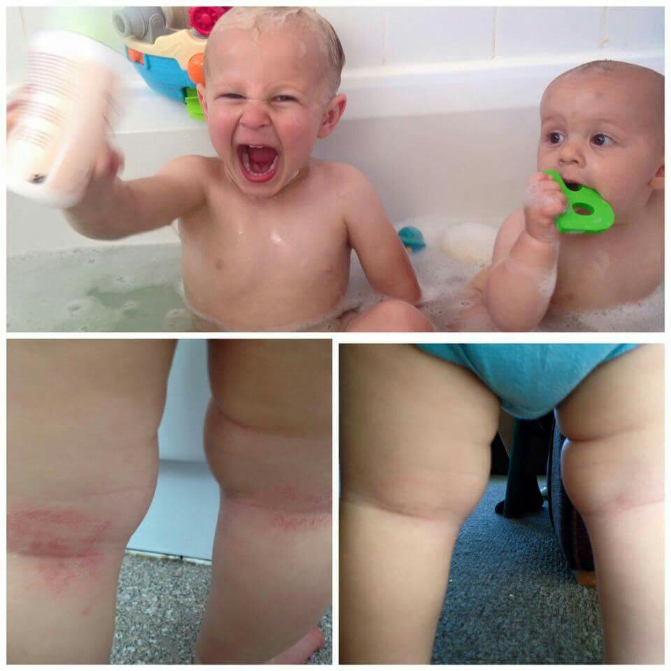 Our Baby Body Wash Is Sooo Good For Your Little Ones Skin And Can Help Dry And Uncomfortable Skin Conditions Belleza